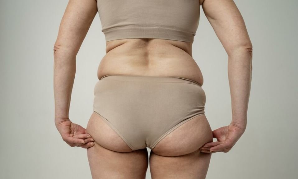 what is bbl surgery