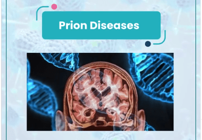 Prion Disease Prion Disease