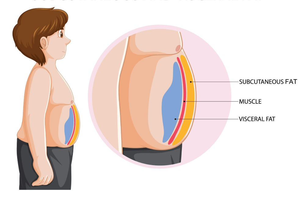 OAGB Surgery